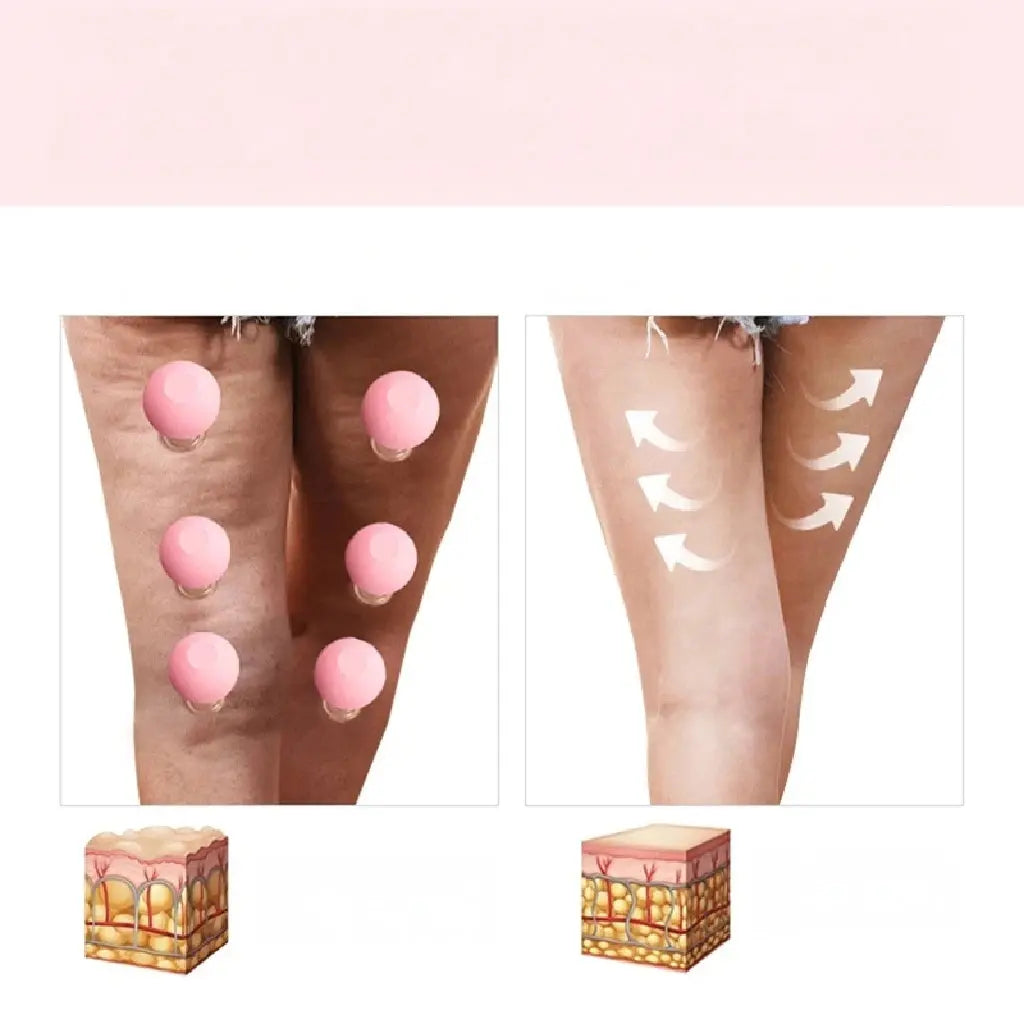 Kit de Ventosa de Vidro Anticelulite para Lifting Facial e Massagem - Vivariso